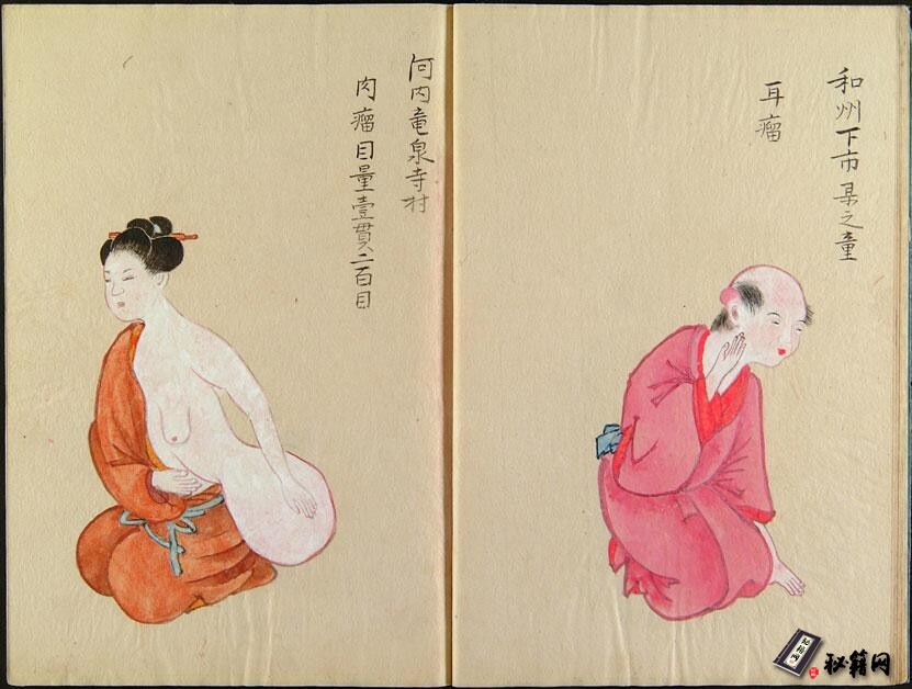 一本非常罕见介绍各种癌瘤的彩印中医古籍《華岡塾癌着色図》